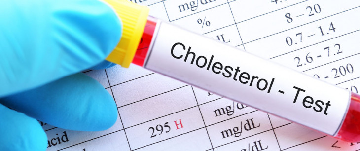 CHOLESTEROL v tabuľkách – čo znamenajú jednotlivé hodnoty